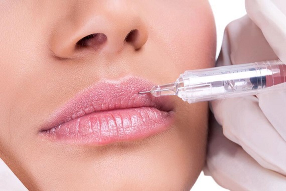 Увеличение губ гиалуроновой кислотой: методы, препараты, процедуры